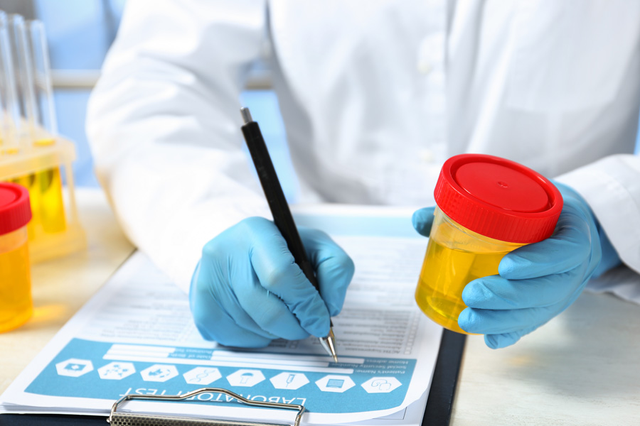 Urine Testing